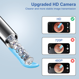 Penghilang kotoran telinga kamera otoskop Wifi portabel pembersih telinga Visual elektrik pintar nirkabel sendok tusuk telinga Visual - Product Image 5