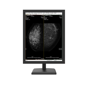 Alta Qualidade Equipamentos Médicos 5MP Grayscale Mammography Diagnostic Display - Product Image 5