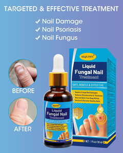 สารละลายของเหลวที่มีประสิทธิภาพสำหรับ Onychomycosis เพื่อล้างเชื้อราและส่งเสริมการเจริญเติบโตของเล็บ - Product Image 2