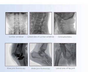 Perlove Mobile C-arm рентгеновская система, цифровая FPD процветоскопия C Arm Xray - Product Image 4