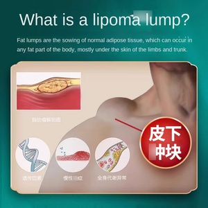 Wofo Fat Kang Ointment From Thailand Subcutaneous <strong>Nodule</strong> Mass Bulge Factory Direct From Sanjie Tongluo Chinese Plaster <strong>Product</strong>