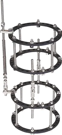 Ortopédica de instrumentos ortopédicos, instrumentos ortopédicos de arov, fixador externo opcional, fixação