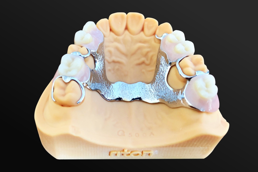 Kleine intelligente Maschinen Dia150mm Slm 3d Druckfür zahnmedizinisches RITON 5