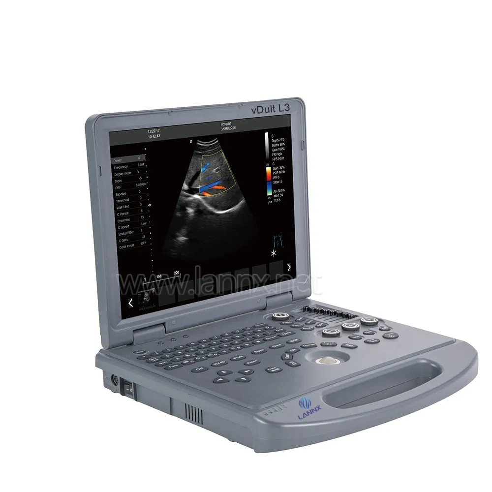 Animal portátil cor Doppler ultra-som veterinário máquina ecografo veterinária ultra-som scanner preço veterinário
