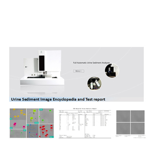 Phòng Thí Nghiệm Tự Động Nước Tiểu Trầm Tích Phân Tích Nước Tiểu Phân Tích - Product Image 6