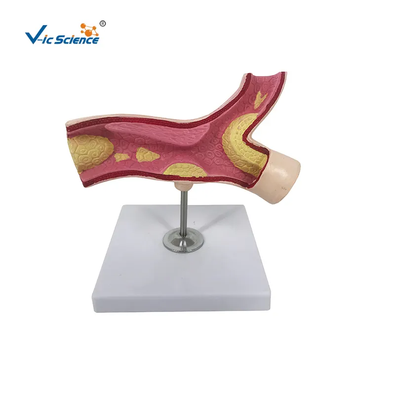 Arterienabschnitt Anatomie-Modell anatomische Modelle vaskuläre anatomische Modelle Blutgefäße