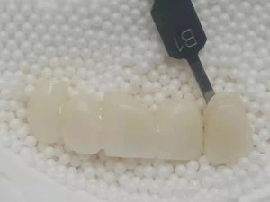 Blocs multicouches de zircone de système dentaire Cadcam translucide superbe de Honchon 98mm - Product Image 6