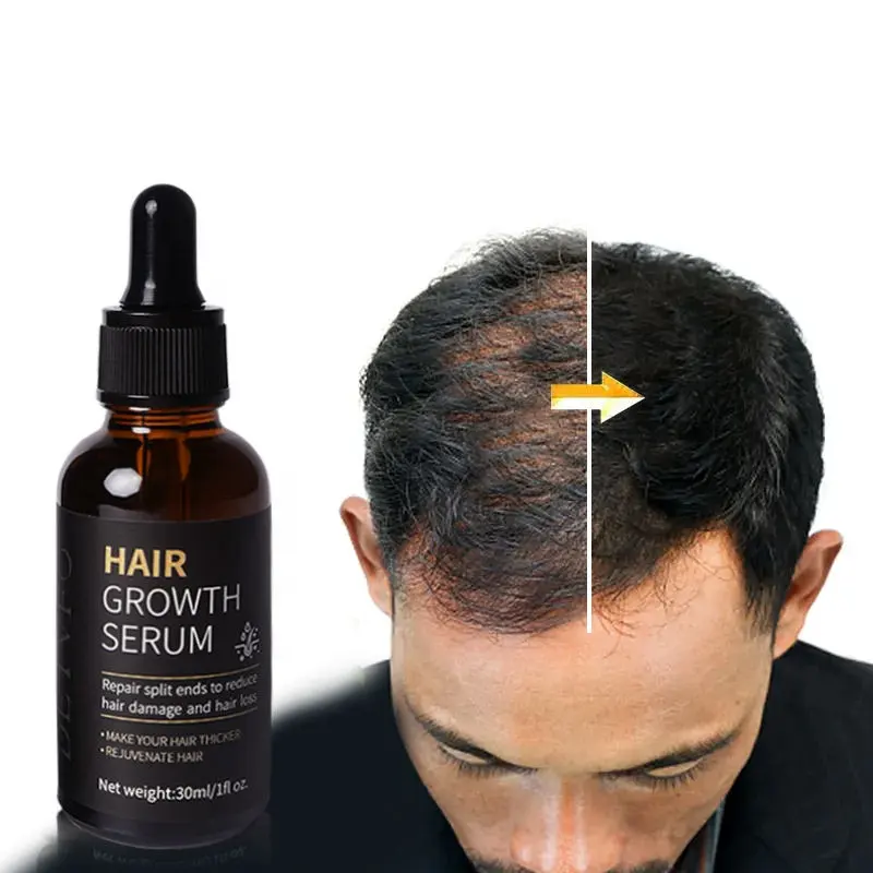 OEM 100% Natural Formula Wholesale Biotin Hair Growth Serum Treatment Hair Growth Oil For Black Women Private Label