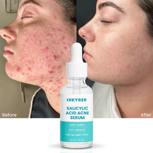 Chống mụn trứng cá mặt huyết thanh Niacinamide Hữu Cơ Salicylic acid cho lỗ chân lông đốm đen giảm nếp nhăn cải thiện kết cấu da - Product Image 1