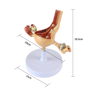 医学モデルの工場人間解剖学的病理学子宮モデル - Product Image 2