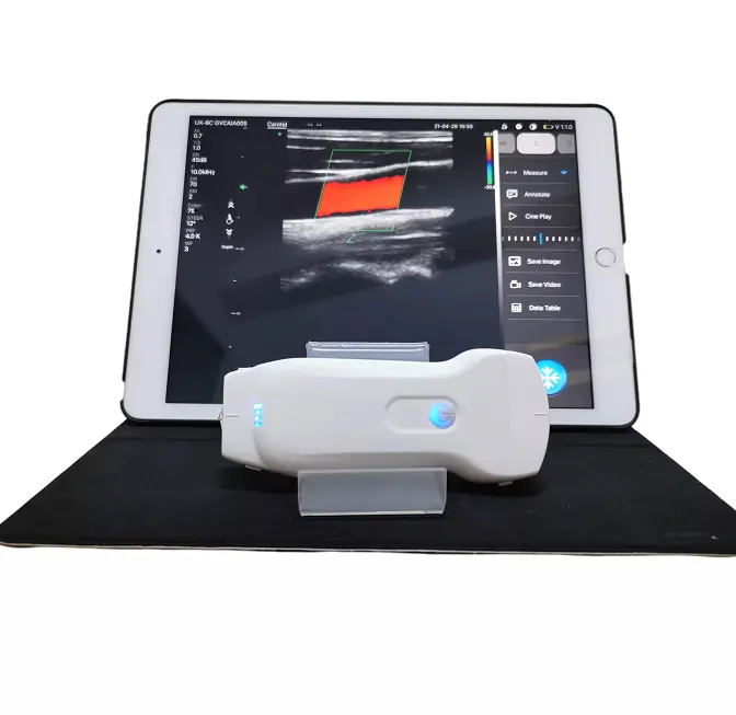 Mc27 scanner de sonda ultrassom com duas cabeças, com wifi e usb convexo, linear e cardiac para humano ou veterinário