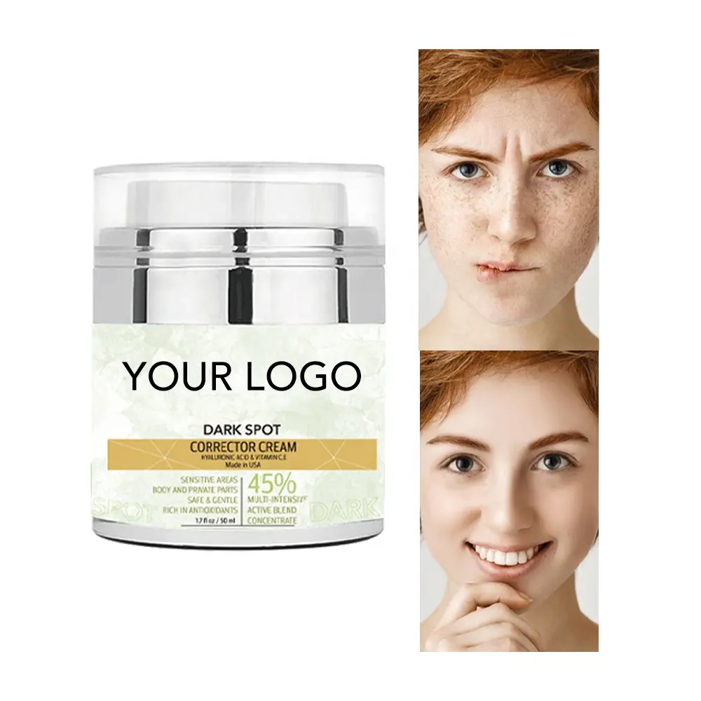 Crema facial iluminadora Crema hidratante para el acné Crema eficaz para eliminar pecas Crema correctora de manchas oscuras