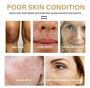 Glutathion Koji säure Serum Vitamin C Aufhellende Sommersprossen Entfernen von Gesichts serum Aufhellung behandlung OEM/ODM - Product Image 5