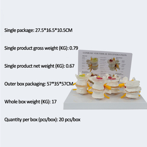 SCIEDU Teaching Resource Medical <strong>Human</strong> Skeleton Model Comparative Model of 4-stage Pathological Lumbar Spine with <strong>Back</strong> Card - Product Image 6