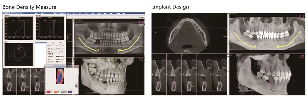 Digital Radiography Panoramic Dental X Ray Machine 3 Hd1cf82f0f66e4f49a8ddabcf7bf2170ff