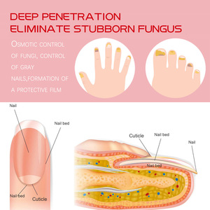 สาระสำคัญของการดูแลเล็บซ่อมแซมสำหรับเล็บสีเหลืองและหนาการรักษาให้ความชุ่มชื้นสำหรับเล็บที่เสียหาย - Product Image 4