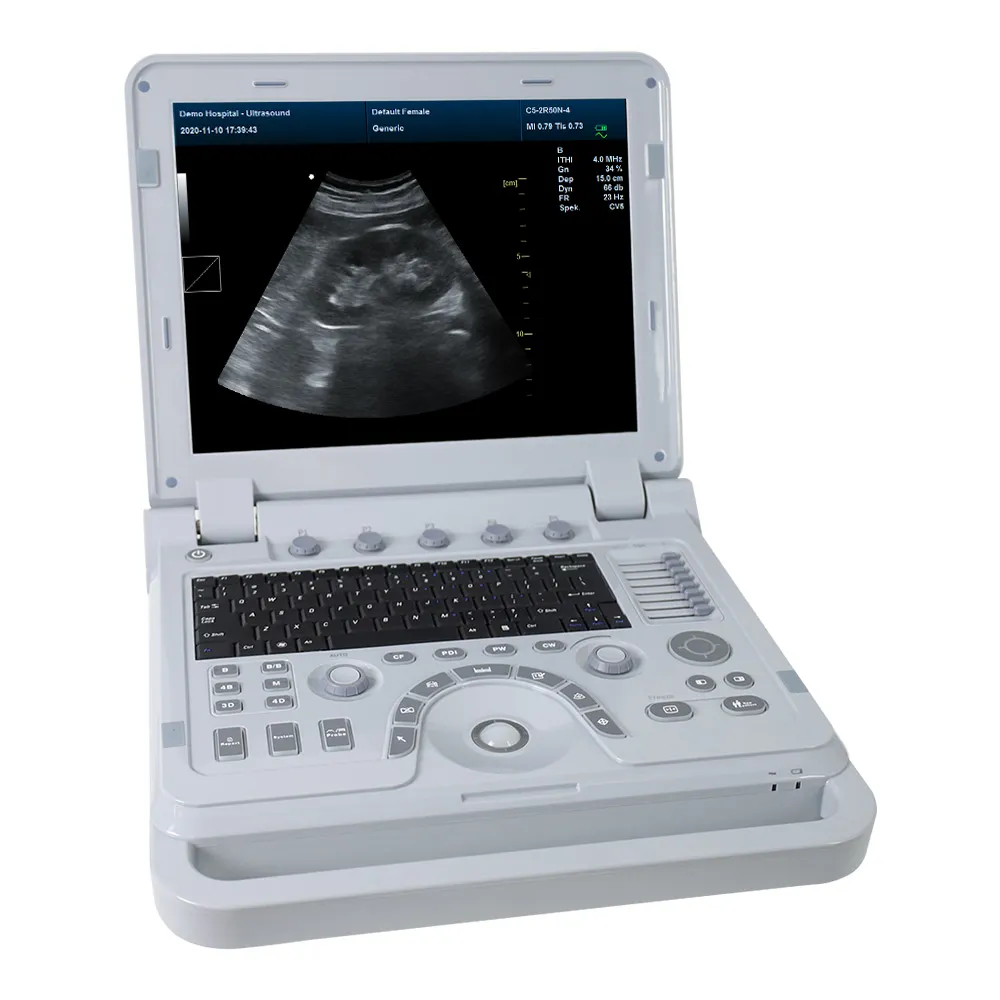 CONTEC CMS1700A renkli doppler kardiyak ultrason tarayıcı taşınabilir ekokardiyografi makinesi