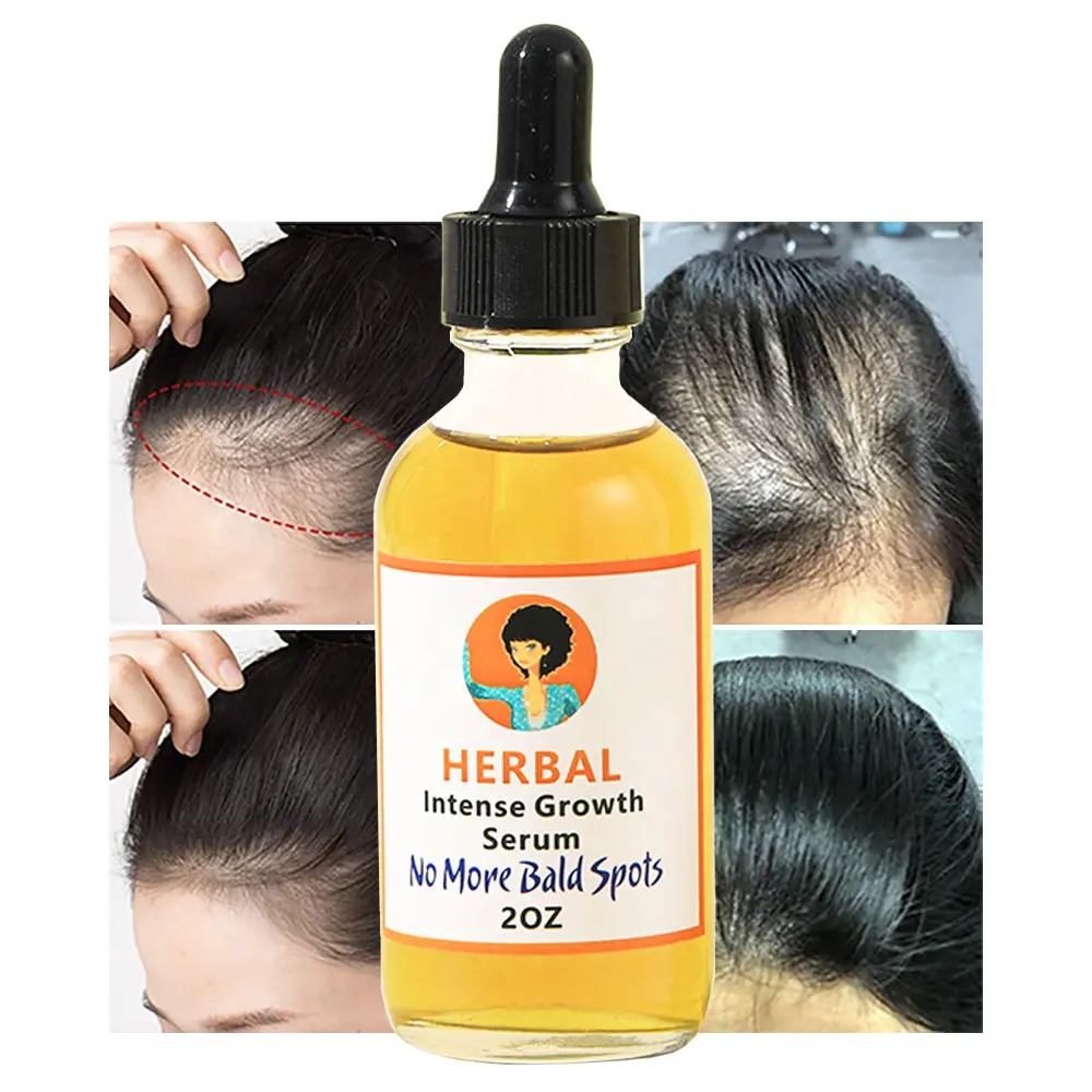 Private Label Capelli Olio di Crescita Perfetto Naturale Lisciatura Dei Capelli Trattamento di Perdita di Olio Biologico DHT Bloccante Vitamine Oli La Crescita Dei Capelli