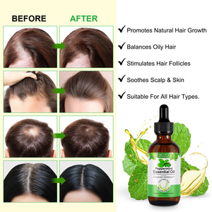 Aliver bạc hà tinh dầu hữu cơ tiên tiến tinh dầu bạc hà tinh dầu cho thúc đẩy tăng trưởng tóc - Product Image 4