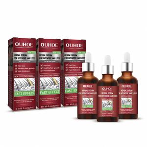 OUHOE Wholesale Private Label 50ml Herbal Dermagen <strong>Forte</strong> Serum for Anti Hair Loss and All Hair Types - Product Image 2