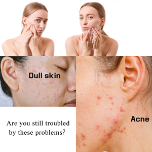 Ban Đầu Kojic San Xà Phòng Nhà Sản Xuất Chăm Sóc Mặt Sáng Nghệ Và Kojic Axit Xà Phòng Trên Khuôn Mặt Đốm Đen Sáng Làm Sạch - Product Image 2