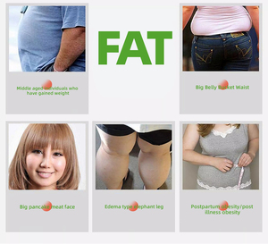 HuainanHall bitkisel ürün yanan yağ karın yamalar vücut şekillendirme ince çıkartmalar kilo kaybı mıknatıs göbek ince yama - Product Image 5