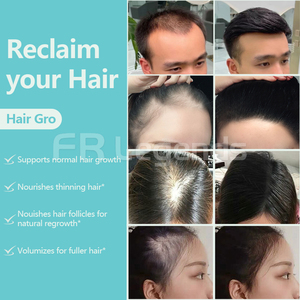 Klaar Om Te Verzenden Hete Verkoop Geavanceerde Haargezondheidspillen Professionele Kracht Haargroei Voedingssupplementen Haargroeitabletten - Product Image 4