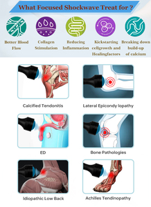 Focus Shockwave Fisioterapia Dispositivo Dor Relief Vet Pneumática Focada Eswt Shock Wave Therapy <span class=keywords><strong>Machine</strong></span> - Product Image 3