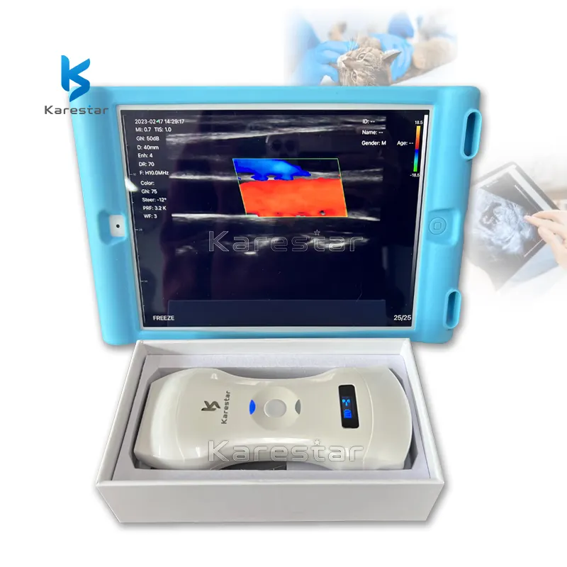 Ultrasonido médico inalámbrico 3 en 1 de mano 192 elementos máquina de ultrasonido veterinario ultrasonido inalámbrico convexo y lineal