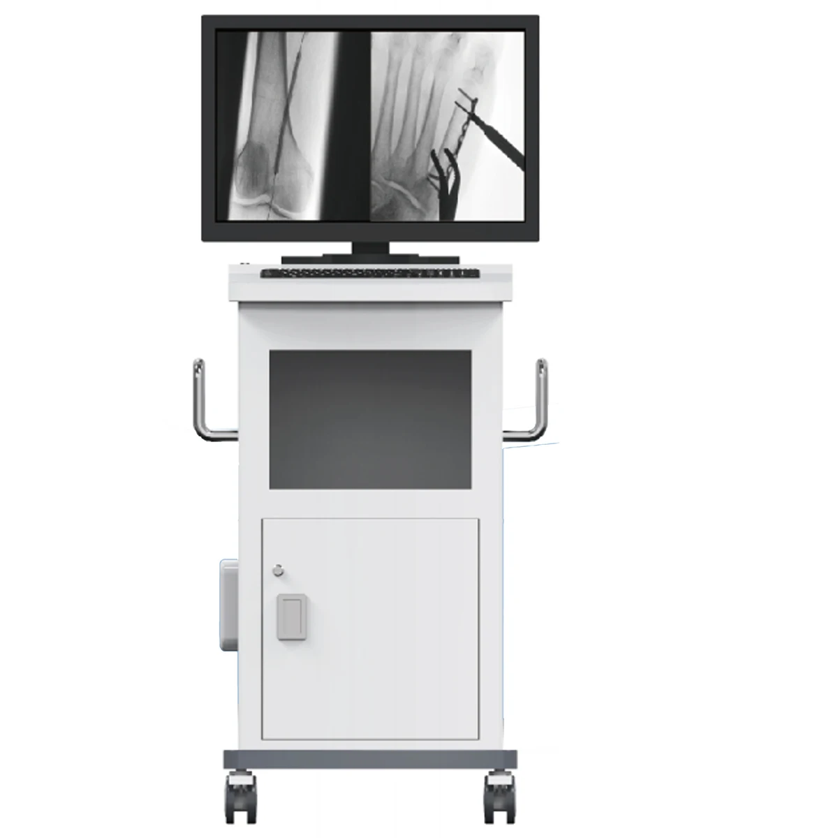 Mobile c arm x-ray machine high frequency digital x ray machine mobile x-ray machine MSLCX50