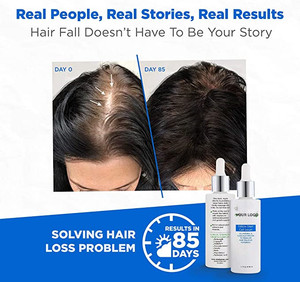 Biotin Vitamin B7 saç büyüme Serum besleyici ve ferahlatıcı saç bakımı ve saç derisi folikülü tedavisi saç çıkma destekler - Product Image 3