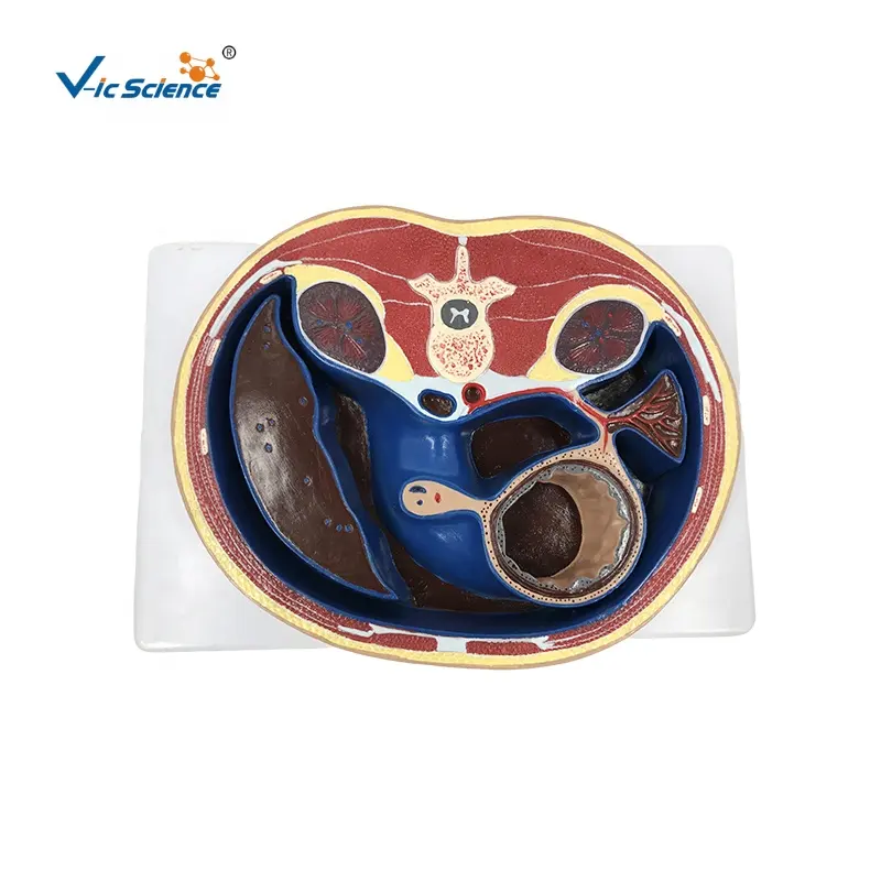 Cross Section through Abdomen (T12) anatomic heart anatomical models blood vessels