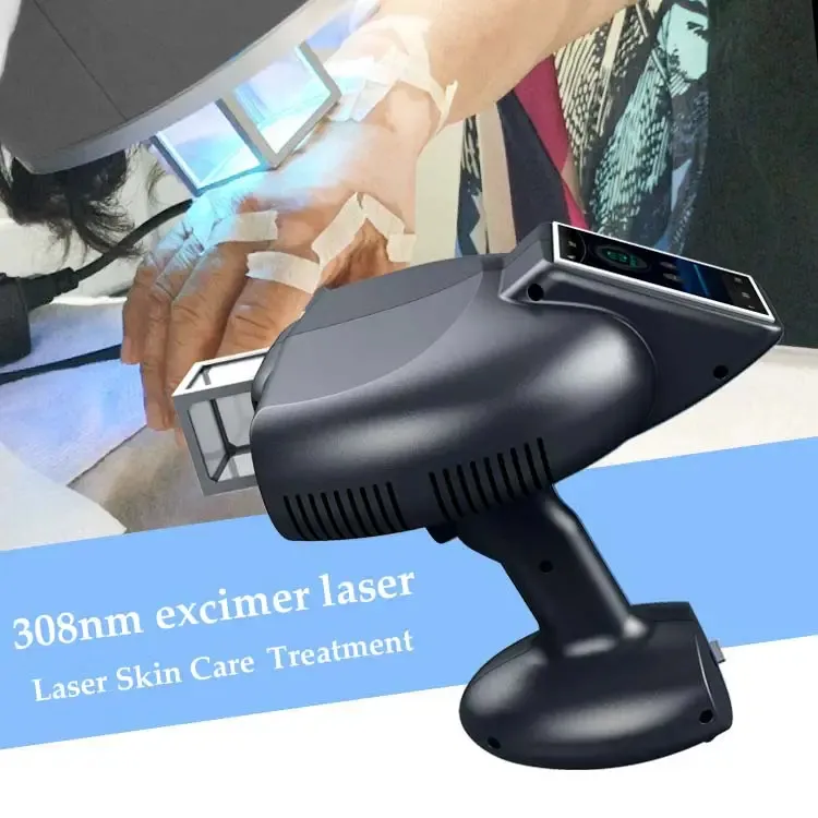 Machine d'équipement de physiothérapie de lampe laser d'excimère de traitement de tache blanche 308nm 308 nm pour le psoriasis de vitiligo pour le désordre de peau