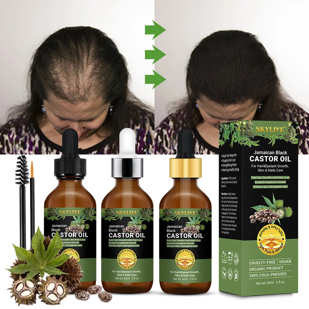Label privé meilleure formule naturelle et biologique pour femmes noires huile de romarin de ricin jamaïcain rapide huile de croissance de cheveux de bébé pour la croissance des cheveux