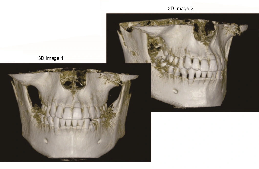 Digital Radiography Panoramic Dental X Ray Machine 4 Hd946f328a2f74a1d84a50bc088de01f4e