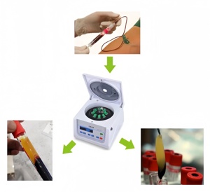 Centrífuga médica profissional dental de alta qualidade adequada para clínicas dentárias e hospitais - Product Image 4