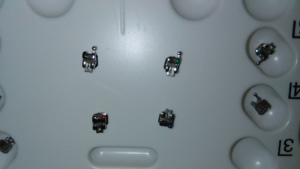 022 正畸金属自锁托槽罗斯MBT托槽被动v型槽可结合 3 钩 345 带钩 - Product Image 3