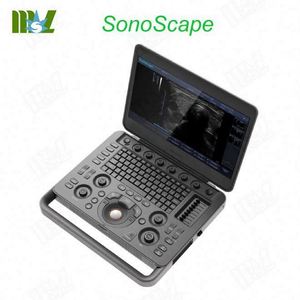 Tiên tiến và di động SONOSCAPE X3 kỹ thuật số siêu âm DOPPLER màu máy siêu âm - Product Image 1
