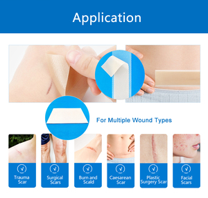 Oem זמין היפואלרגני עמיד למים גיליון צלקת סיליקון עמיד למים עבור צלקות ניתוח - Product Image 4