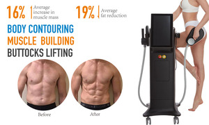 ADSS Muscle Shaping Butt Lifting Elektro magnetischer Körper Abnehmen EMS Maschine für Salon - Product Image 6