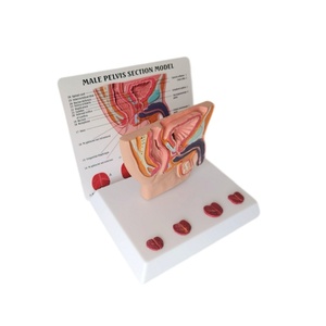 Human Male Abdominal Cavity Bladder Prostate Health Disease Comparison Medical Teaching Doctor-Patient <strong>Explanation</strong> Model - Product Image 1
