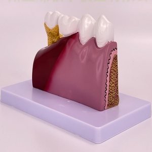 İnsan diş diş patolojik modeli diş ağız boşluğu patolojik Model ekran Model beyin - Product Image 5
