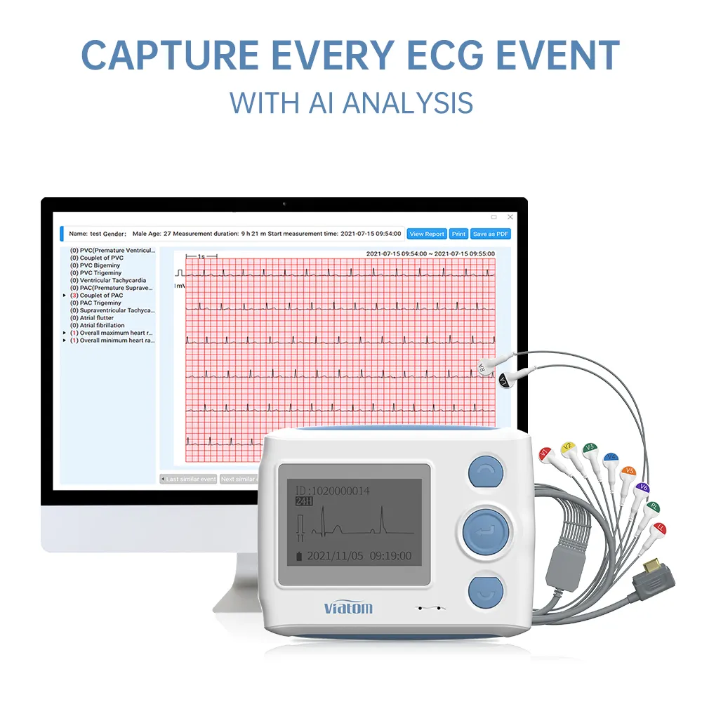 Viatom-máquina de Cable portátil Th12 de 12 canales, grabadora de Monitor Mini Holter, Ecg de cardiolina de plomo, electrocardiógrafo