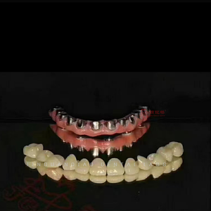 Implant bar Overdenture for All-on-<strong>x</strong> Implant <strong>Restorations</strong> for Dentures Oral Recovery Lab China - Product Image 3