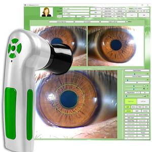 Analizzatore di salute degli occhi 12.0m pixel USB diagnosi iride iride analizzatore iris analizzatore Iris strumento specialista iridologia - Product Image 4