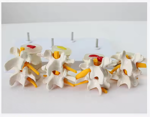 SCIEDU Teaching Resource Medical <strong>Human</strong> Skeleton Model Comparative Model of 4-stage Pathological Lumbar Spine with <strong>Back</strong> Card - Product Image 2
