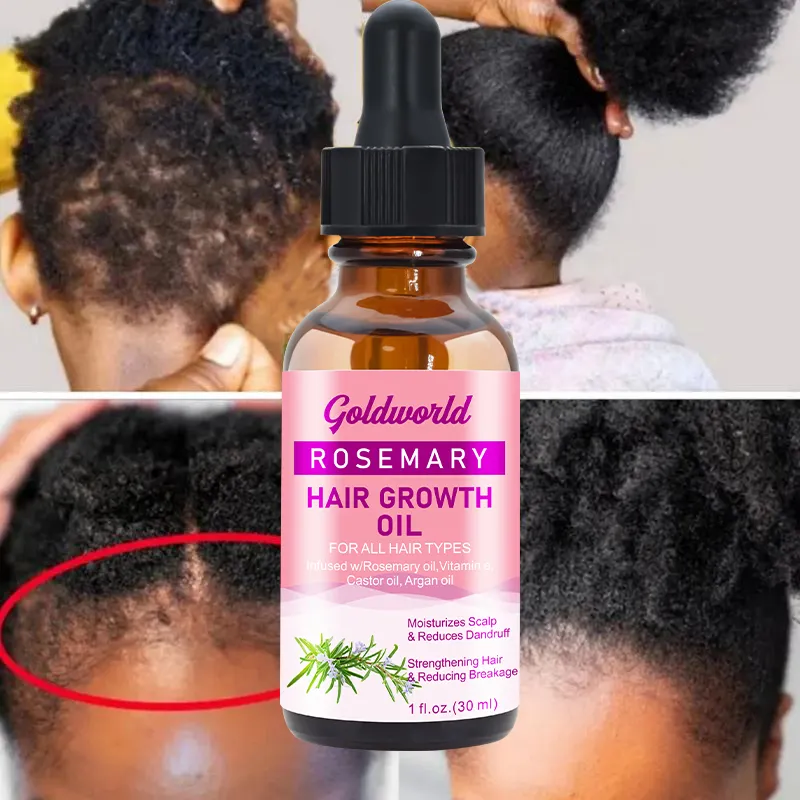 Benutzer definierte Rosmarin Minze Haaröl Bio Serum Marokko Arganöl Langes Haar Wachstum Öl Private Label für Afro-Haar