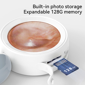 Sunuo เครื่องตรวจจับช่องหูอัจฉริยะ1080P HD สำหรับ2025เด็กและสัตว์เลี้ยงพร้อมหน้าจออัจฉริยะขนาด1.38นิ้วสำหรับกำจัดขี้หูในบ้าน - Product Image 6