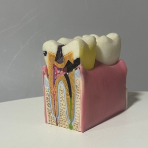 Model gigi PVC manekin untuk kerusakan soptur gigi tiruan proses pengajaran peralatan pendidikan untuk praktek medis dokter gigi - Product Image 5