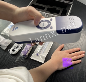 LANNX UVF 500A Alat Pencari Lokasi, Proyeksi Medis Vein Viewer, Perangkat Detektor Vaskular, Klinik Iluminator Rumah Sakit, Pencari Pembuluh Darah Portabel - Product Image 3